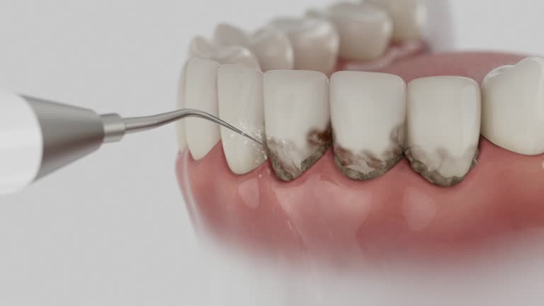 Reliable Wisdom Tooth Removal contractor in Scott County County, AR by Dentist Open Now